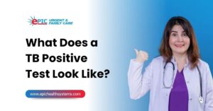 what-does-a-tb-positive-test-look-like